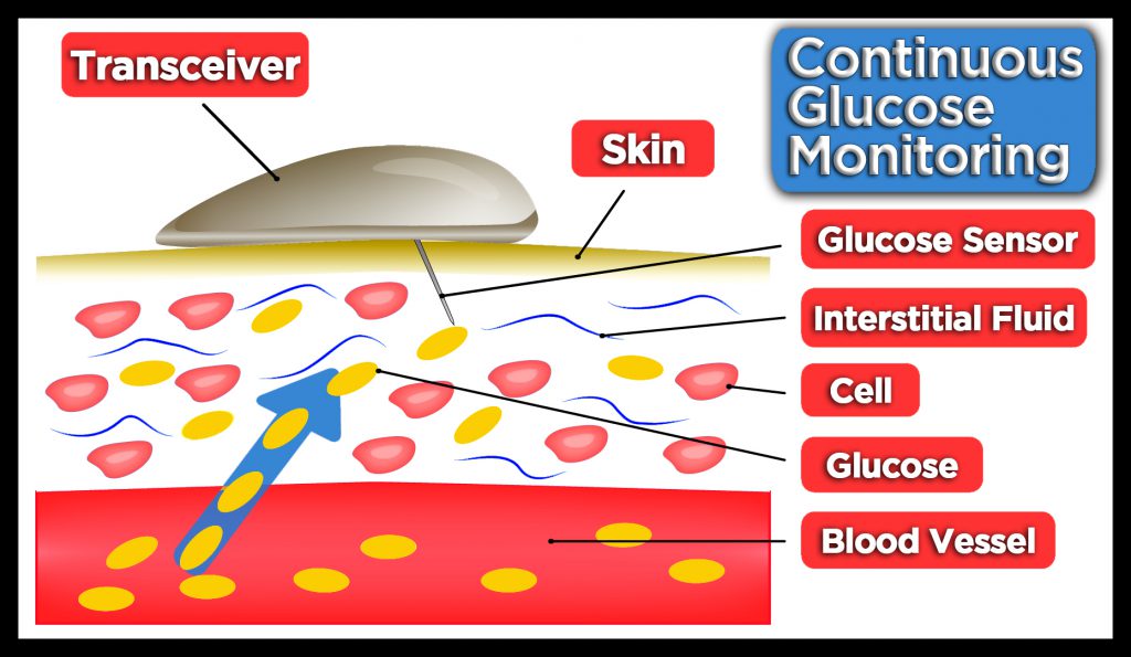 CGM Graphic