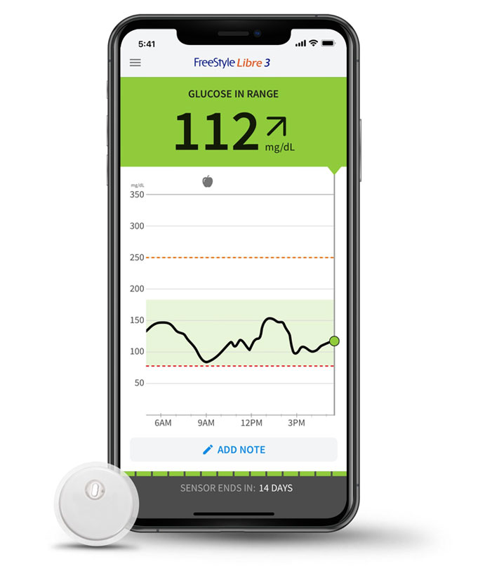Abbott FreeStyle Libre 3 and smartphone app